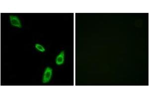 Immunofluorescence analysis of LOVO cells, using ADRA1B Antibody. (ADRA1B Antikörper  (AA 431-480))