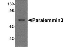Western blot analysis of Paralemmin3 in MCF7 cell lysate with Paralemmin-3 Cat. (PALM3 Antikörper  (N-Term))