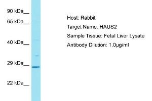 Host: Rabbit Target Name: HAUS2 Sample Tissue: Human Fetal Liver Antibody Dilution: 1ug/ml (HAUS2 Antikörper  (C-Term))