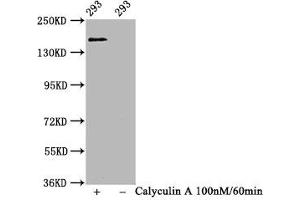 Western Blot Positive WB detected in 293 whole cell lysate(treated with Calyculin A or not) All lanes Phospho-SMC1A antibody at 1. (Rekombinanter SMC1A Antikörper  (pSer957))