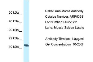 Western Blotting (WB) image for anti-MORN Repeat Containing 4 (MORN4) (C-Term) antibody (ABIN2785367) (MORN4 Antikörper  (C-Term))