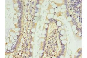 Immunohistochemistry of paraffin-embedded human small intestine tissue using ABIN7152903 at dilution of 1:100 (FSCB Antikörper  (AA 1-200))