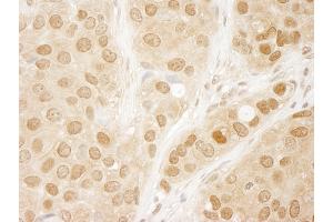 Immunohistochemistry (IHC) image for anti-V-Akt Murine Thymoma Viral Oncogene Homolog 1 (AKT1) (AA 25-75) antibody (ABIN7448406) (AKT1 Antikörper  (AA 25-75))