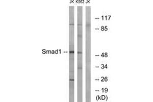 Western blot analysis of extracts from Jurkat/K562 cells, using Smad1 (Ab-187) Antibody. (SMAD1 Antikörper  (AA 153-202))