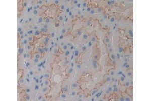 Used in DAB staining on fromalin fixed paraffin- embedded kidney tissue (PTPMT1 Antikörper  (AA 71-197))
