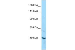 Western Blotting (WB) image for anti-Receptor Tyrosine Kinase-Like Orphan Receptor 1 (ROR1) (C-Term) antibody (ABIN2789668) (ROR1 Antikörper  (C-Term))