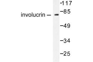Image no. 1 for anti-Involucrin (IVL) antibody (ABIN265482) (Involucrin Antikörper)