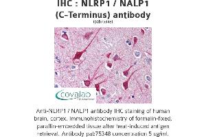 Image no. 1 for anti-NLR Family, Pyrin Domain Containing 1 (NLRP1) antibody (ABIN1737385) (NLRP1 Antikörper)