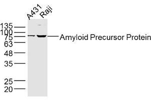 Lane 1: A431 lysates Lane 2: Raji lysates Jurkat lysates probed with Amyloid Precursor Protein Antibody, Unconjugated  at 1:300 dilution and 4˚C overnight incubation. (APP Antikörper  (AA 381-480))