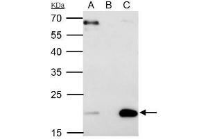IP Image Sorcin antibody [N1C3] immunoprecipitates Sorcin protein in IP experiments. (SRI Antikörper)