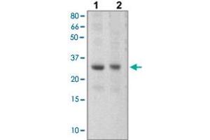 The tissue lysates derived from mouse liver (Lane 1), mouse muscle (Lane 2) were immunoprobed by SOCS3 polyclonal antibody  at 1 : 500. (SOCS3 Antikörper  (C-Term))