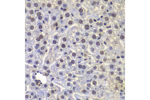 Immunohistochemistry of paraffin-embedded mouse liver using FUBP3 antibody at dilution of 1:100 (40x lens).