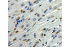 Used in DAB staining on fromalin fixed paraffin-embedded Heart tissue (SMAD6 Antikörper  (AA 261-495))