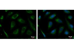 ICC/IF Image PRKCSH antibody detects PRKCSH protein at endoplasmic reticulum by immunofluorescent analysis. (PRKCSH Antikörper)