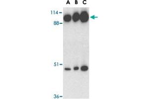 Western blot analysis of ACE2 in human kidney tissue lysate with ACE2 polyclonal antibody  at 0. (ACE2 Antikörper  (C-Term))
