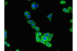 Immunofluorescent analysis of HepG2 cells using ABIN7147577 at dilution of 1:100 and Alexa Fluor 488-congugated AffiniPure Goat Anti-Rabbit IgG(H+L)