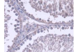 DAB staining on IHC-P; Samples: Rat Testis Tissue (RNASEH2A Antikörper  (AA 1-301))