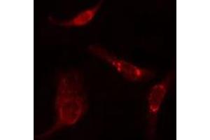 ABIN6275791 staining  HuvEc cells by IF/ICC. (TUBA3C/E Antikörper)