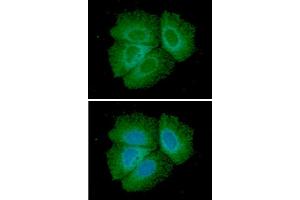 ICC/IF analysis of Adiponectin in Hep3B cells line, stained with DAPI (Blue) for nucleus staining and monoclonal anti-human Adiponectin antibody (1:100) with goat anti-mouse IgG-Alexa fluor 488 conjugate (Green).