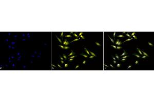 Immunocytochemistry/Immunofluorescence analysis using Rabbit Anti-Calreticulin Polyclonal Antibody (ABIN361834 and ABIN361835). (Calreticulin Antikörper)