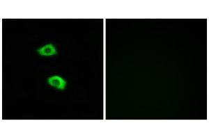 Immunofluorescence analysis of LOVO cells, using OR51B5 antibody. (OR51B5 Antikörper  (Internal Region))