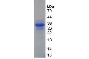SDS-PAGE analysis of Human XPG Protein. (ERCC5 Protein)