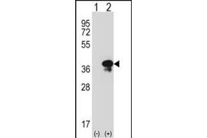 Western blot analysis of STX3 (arrow) using rabbit polyclonal STX3 Antibody (Center) (ABIN389321 and ABIN2839439).