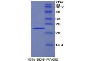 SDS-PAGE (SDS) image for Pronociceptin (AA 12-181) protein (His tag) (ABIN1878242)