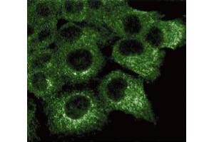 Immunofluorescence staining of A431 cells (Human epithelial carcinoma, ATCC CRL-1555). (HSPA4 Antikörper  (AA 703-858))
