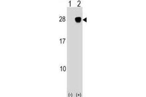 Western Blotting (WB) image for anti-UL16 Binding Protein 2 (ULBP2) antibody (ABIN2999200) (ULBP2 Antikörper)