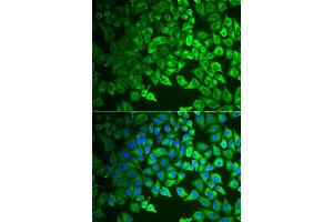 Immunofluorescence analysis of  cells using GIF antibody (ABIN6130975, ABIN6141081, ABIN6141082 and ABIN6222649). (Intrinsic Factor Antikörper  (AA 20-300))