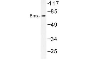 Image no. 1 for anti-BMX Non-Receptor Tyrosine Kinase (BMX) antibody (ABIN317608) (BMX Antikörper)