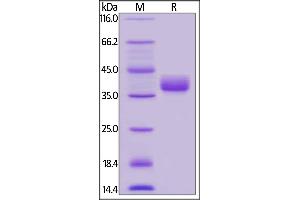 SDS-PAGE (SDS) image for CD52 (CD52) (AA 25-36) (Active) protein (Fc Tag) (ABIN6253630)