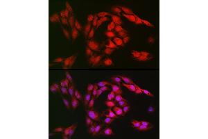 Immunofluorescence analysis of U2OS cells using SOD1 Rabbit pAb (ABIN3020854, ABIN3020855, ABIN3020856 and ABIN6213758) at dilution of 1:150 (40x lens). (SOD1 Antikörper  (AA 1-154))