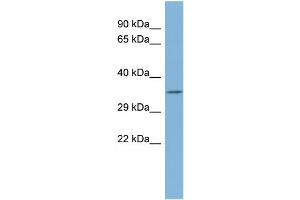 WB Suggested Anti-TTC35 Antibody Titration:  0. (TTC35 Antikörper  (Middle Region))