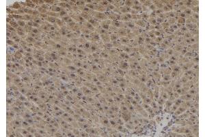 ABIN6261241 and ABIN6276878 at 1/100 staining Mouse liver tissue by IHC-P.