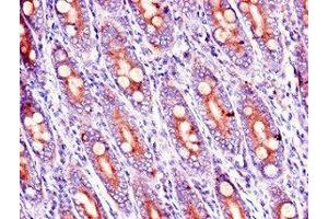 Immunohistochemistry of paraffin-embedded human small intestine tissue using ABIN7167318 at dilution of 1:100 (RAB39B Antikörper  (AA 1-213))