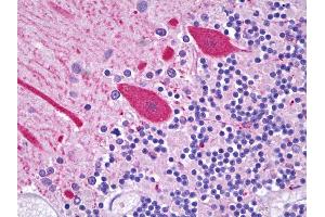 Anti-CES2 / Esterase antibody IHC of human brain, cerebellum, Purkinje cells.