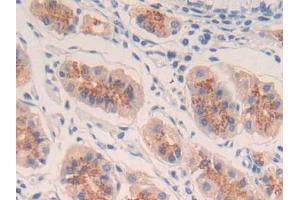 DAB staining on IHC-P; Samples: Human Stomach Tissue (IL-20 Antikörper  (AA 25-176))