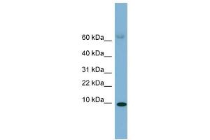 SAA4 antibody used at 1 ug/ml to detect target protein.