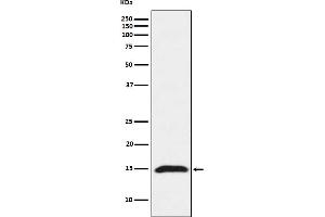 Western blot analysis of Fragilis expression in HeLa cell lysate.
