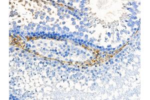 ABIN6257907 and ABIN6275041 at 1/100 staining Rat testis tissue by IHC-P. (HSD11B1 Antikörper  (N-Term))