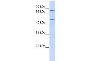 WB Suggested Anti-ERCC8 Antibody Titration: 0. (ERCC8 Antikörper  (N-Term))