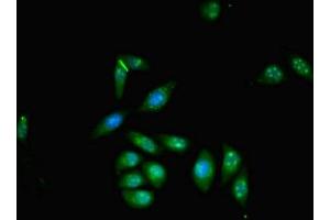 Immunofluorescent analysis of A549 cells using ABIN7176097 at dilution of 1:100 and Alexa Fluor 488-congugated AffiniPure Goat Anti-Rabbit IgG(H+L) (ZMYND11 Antikörper  (AA 363-513))