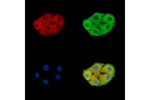 ABIN7096438 and ABIN7100502 staining Hela cells by IF/ICC. (GRAMD1B Antikörper)