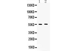 Western blot analysis of MMP11 expression in rat spleen extract ( Lane 1) and MM231 whole cell lysates ( Lane 2). (MMP11 Antikörper  (N-Term))
