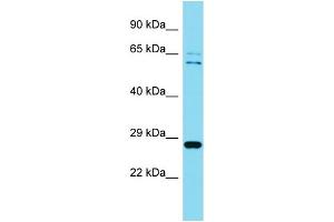 Western Blotting (WB) image for anti-Chromosome 4 Open Reading Frame 43 (C4orf43) (Middle Region) antibody (ABIN2791117) (C4orf43 Antikörper  (Middle Region))