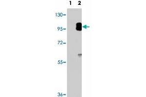 Western blot analysis of PRKG2 (arrow) using PRKG2 polyclonal antibody . (PRKG2 Antikörper  (C-Term))