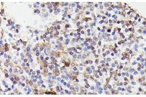 Immunohistochemistry of paraffin-embedded Human tonsil using CDC23 Polyclonal Antibody at dilution of 1:100 (40x lens). (CDC23 Antikörper)