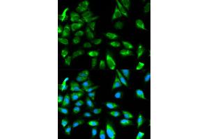Immunofluorescence analysis of HeLa cells using TRAF6 antibody.